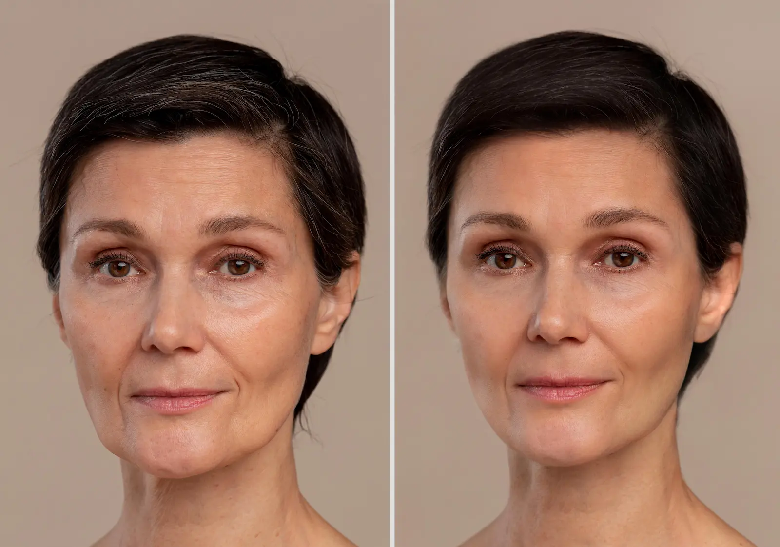 Before and After anti-aging treatment